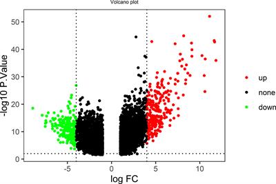 Bioinformatics analysis and validation of the critical genes associated with adamantinomatous craniopharyngioma